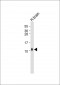 S100B Antibody